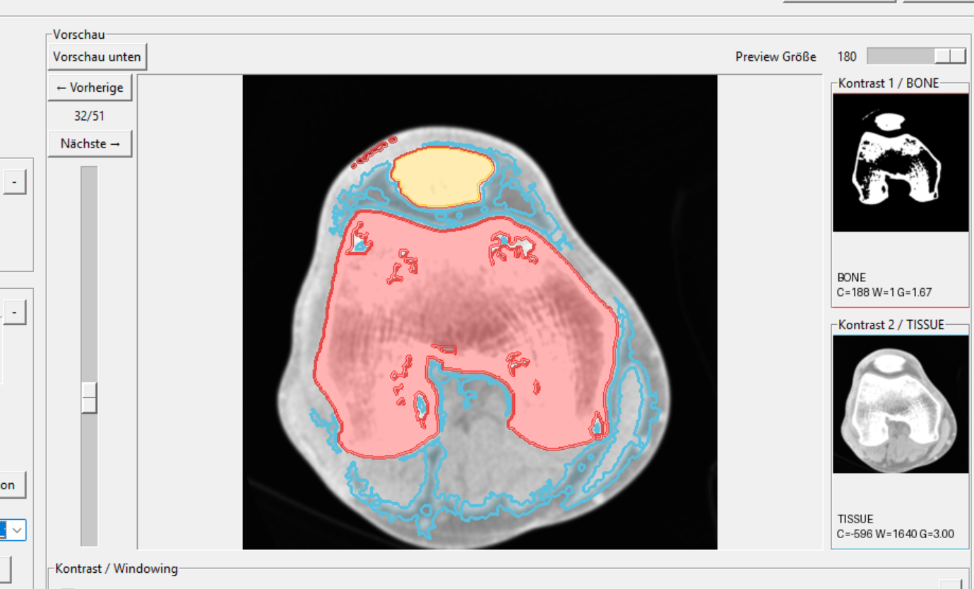 CT3D screenshot: Screenshot 2026 05 29 183233